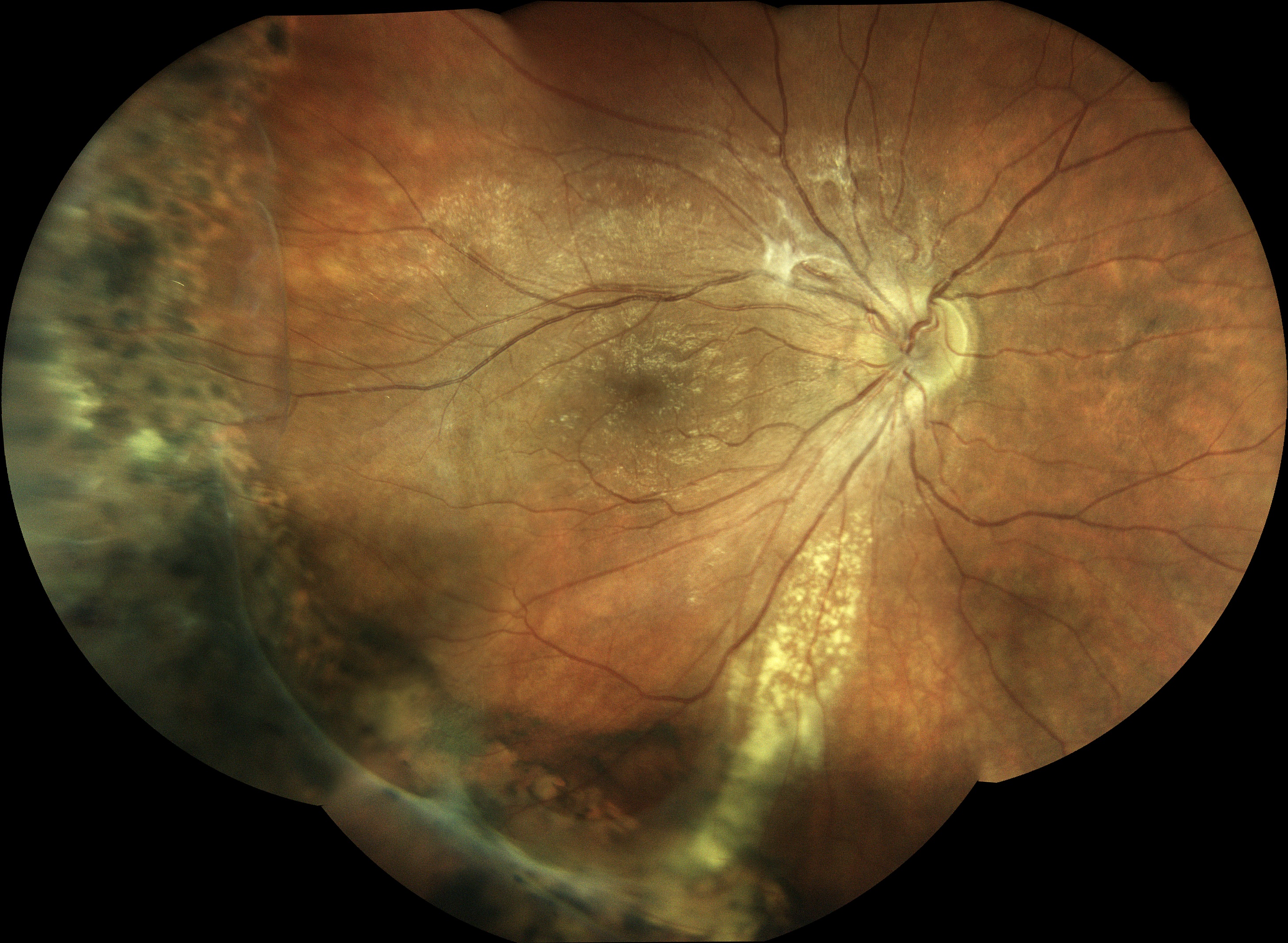  Courtesy of Dr Vincent Gualino, Montauban, France 