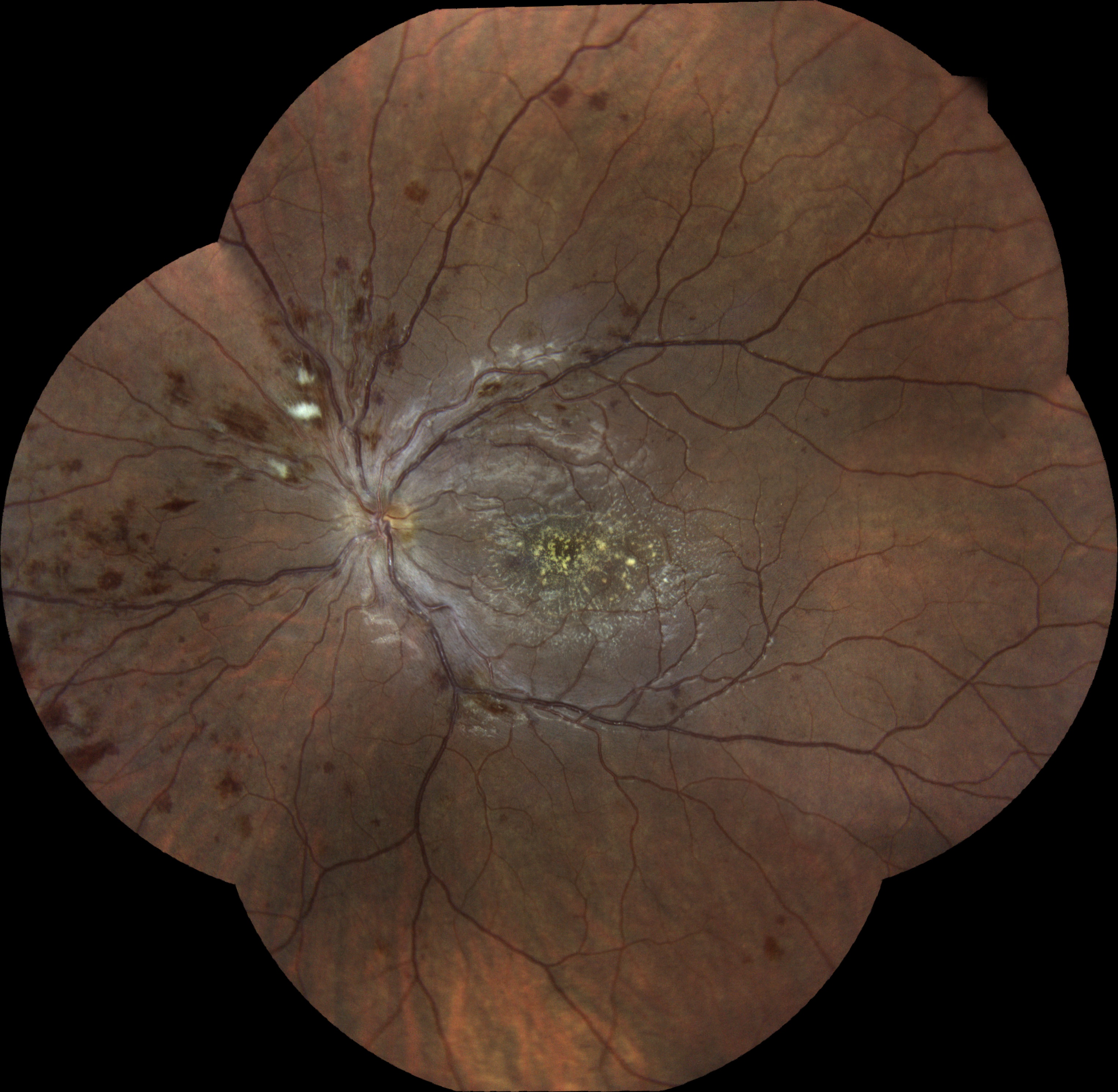  Courtesy of Pr Pierre Labalette, Lille, France 