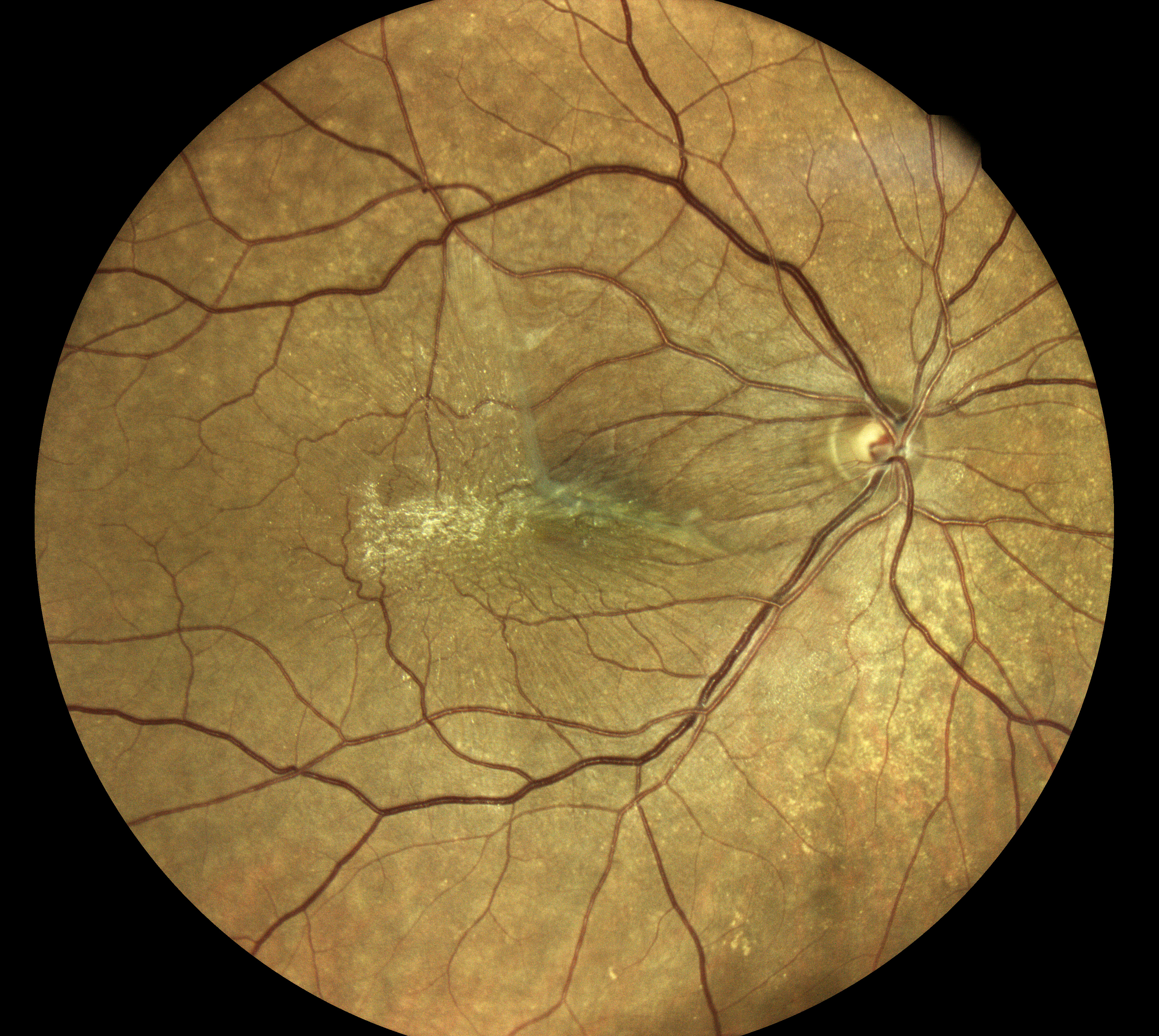  Courtesy of Dr Jean-Michel Muratet, Pamiers, France 