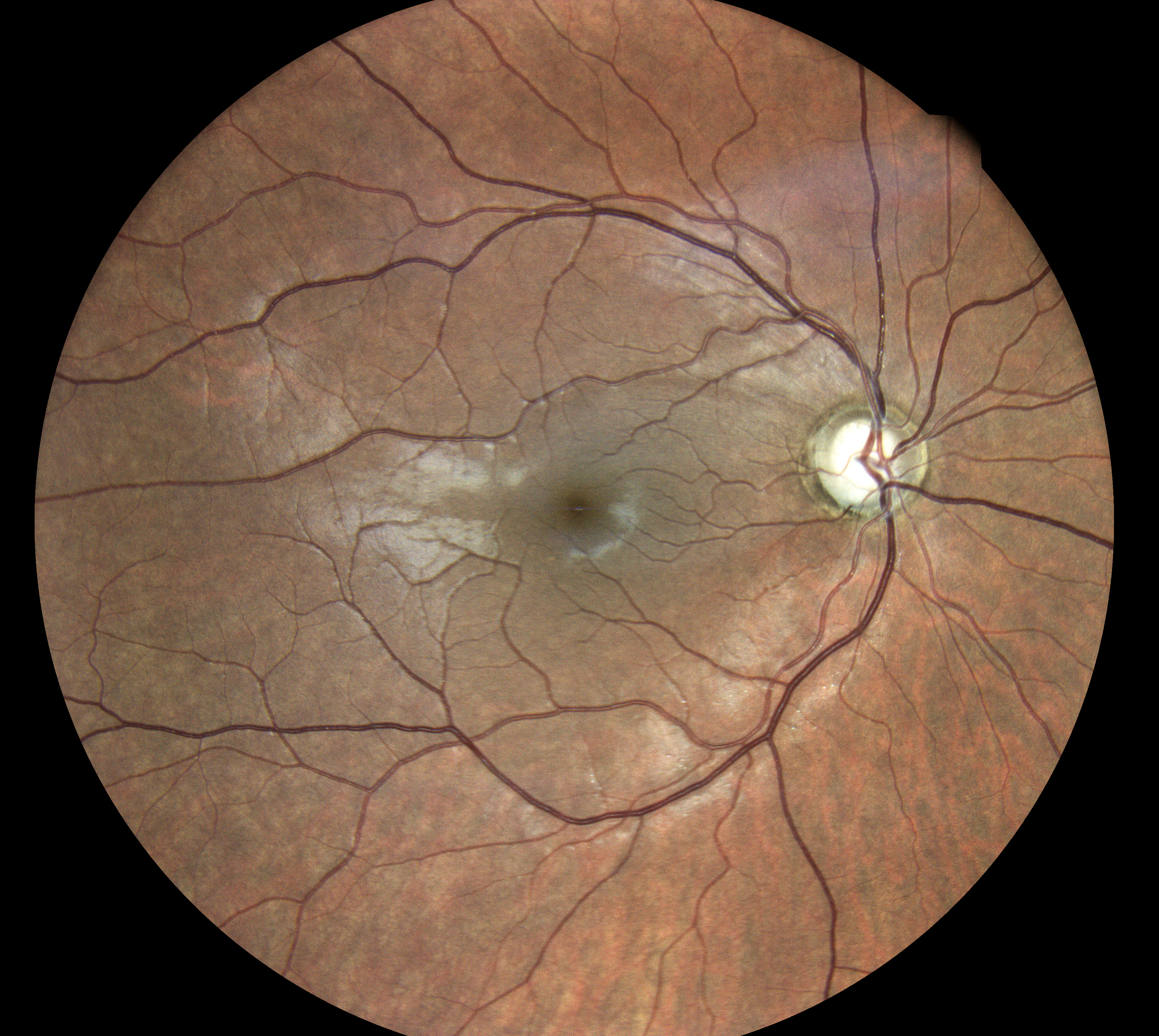  Courtesy of Dr Jean-Michel Muratet, Pamiers, France 