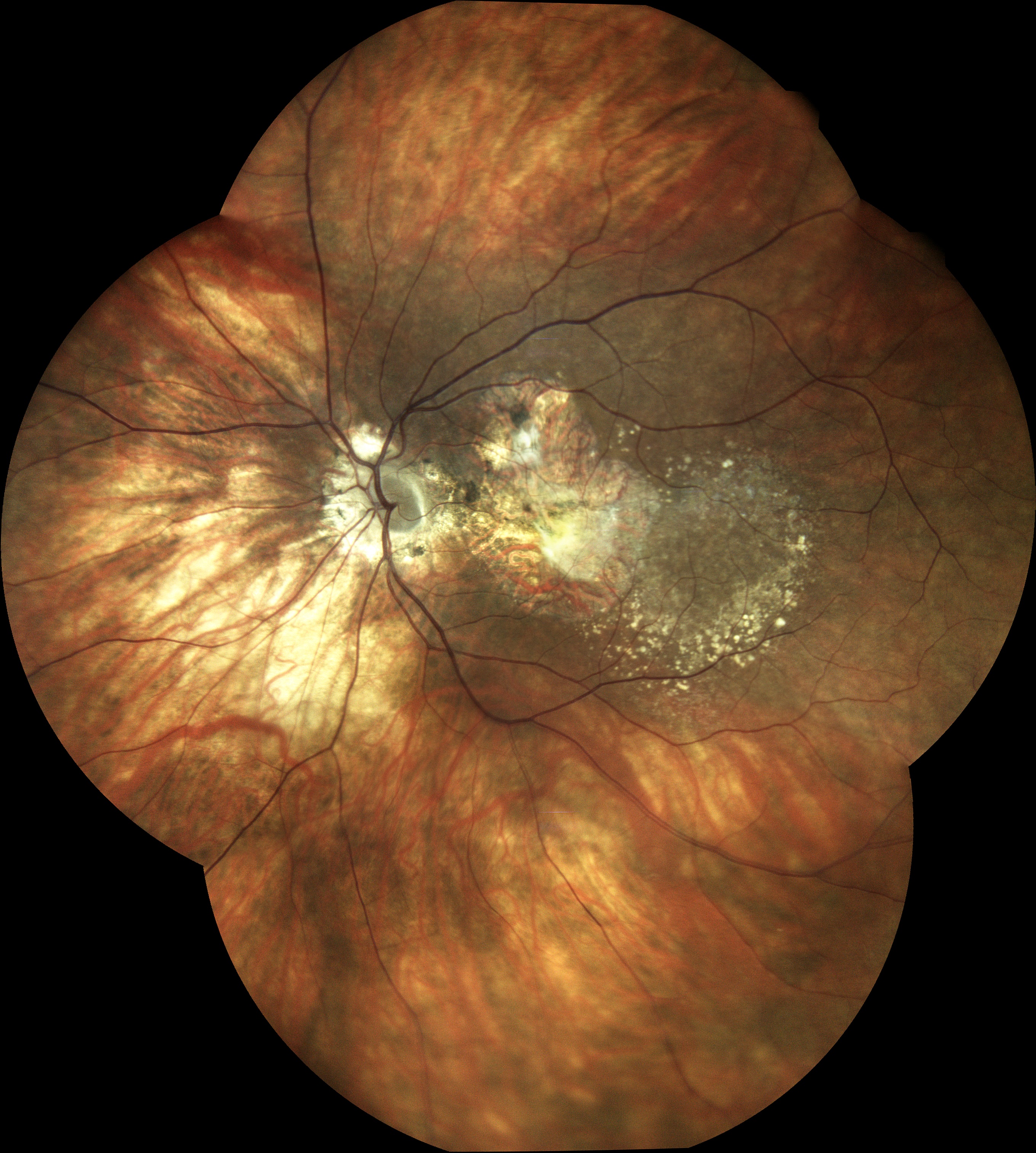  Courtesy of Dr Jean-Michel Muratet, Pamiers, France 