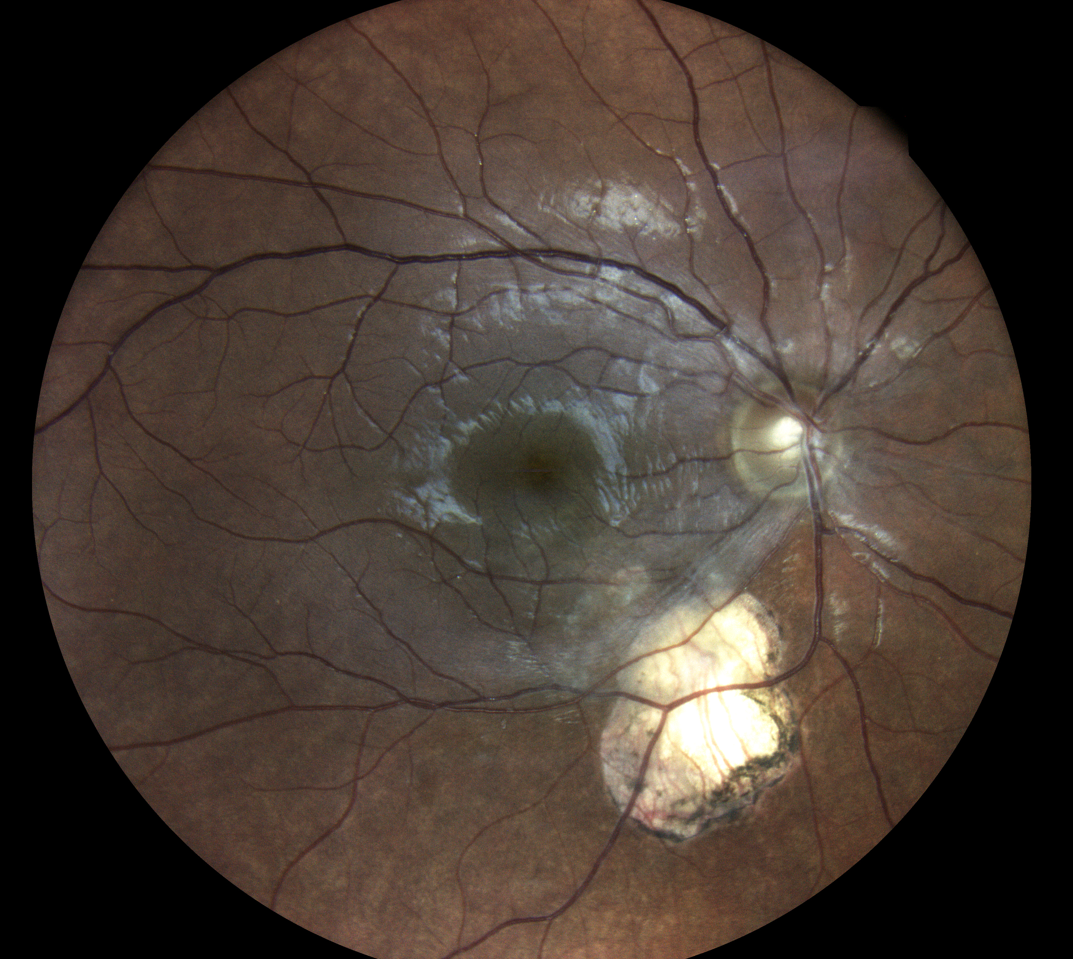  Courtesy of Dr Jean-Michel Muratet, Pamiers, France 