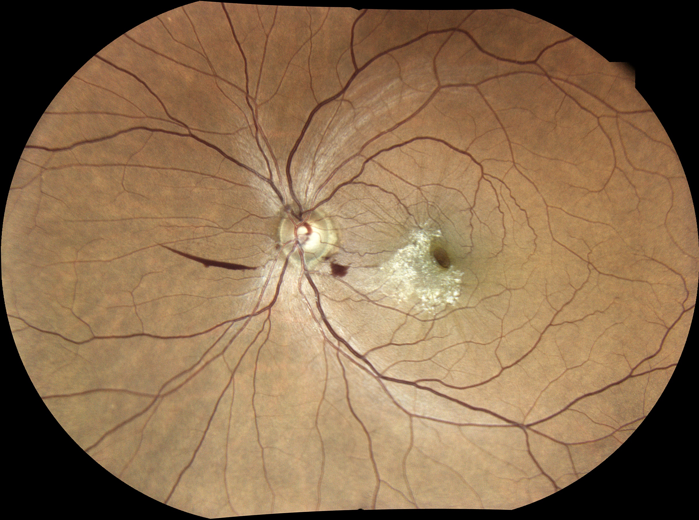  Courtesy of Dr Jean-Michel Muratet, Pamiers, France 