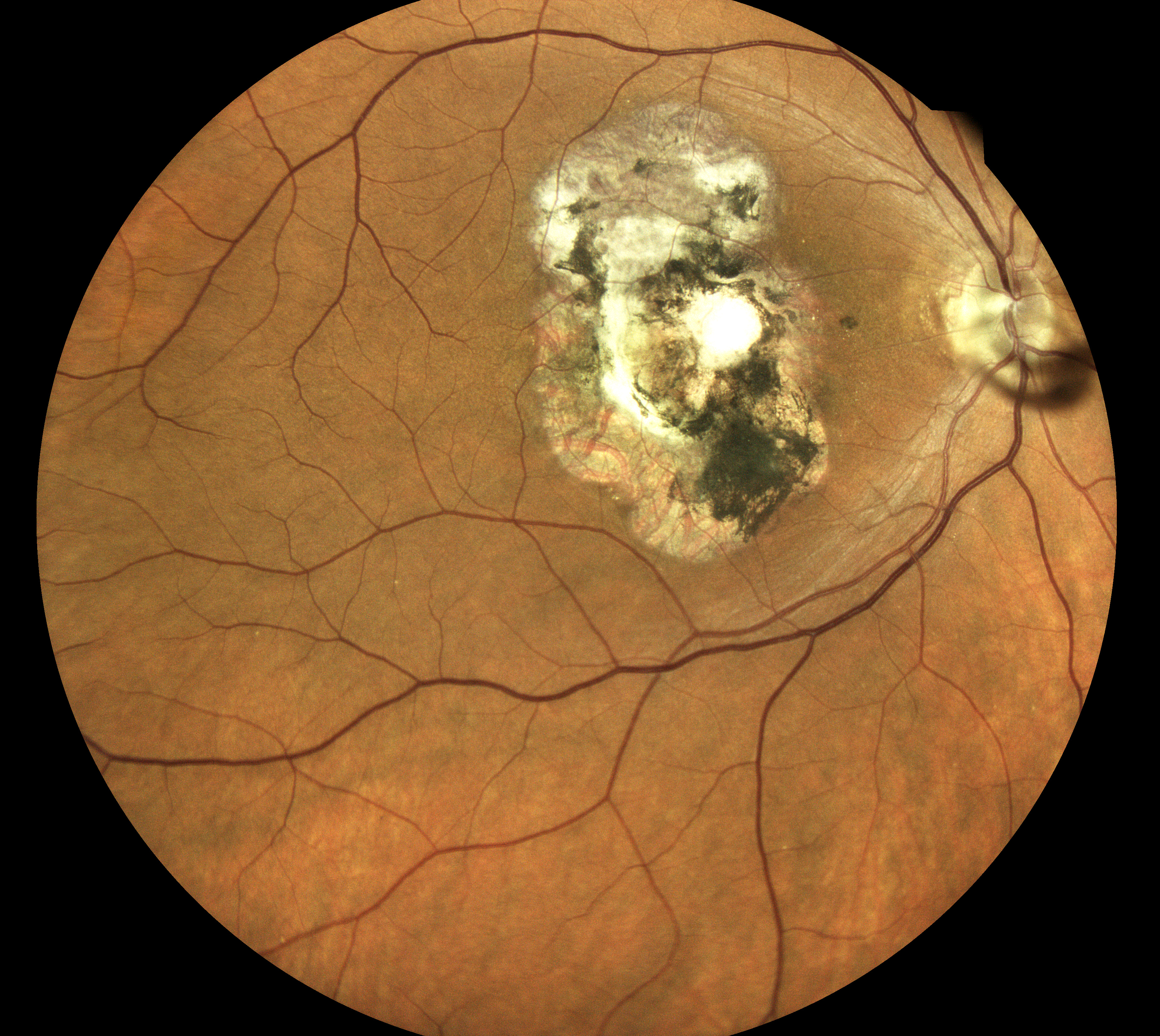  Courtesy of Dr Jean-Michel Muratet, Pamiers, France 