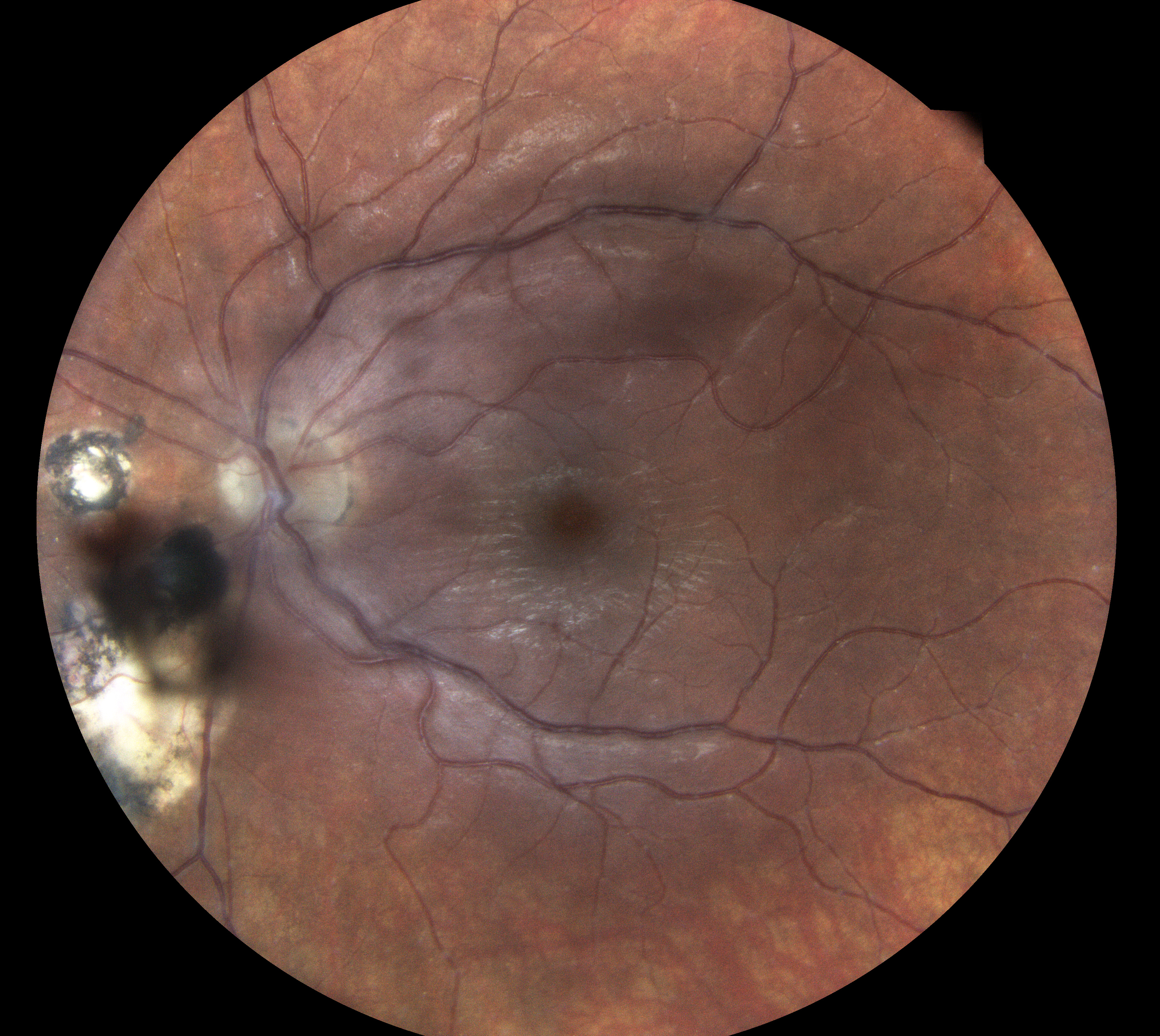  Courtesy of Dr Jean-Michel Muratet, Pamiers, France 